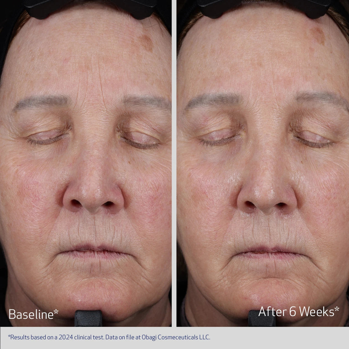 ELASTIderm Lift & Sculpt de Obagi, detalle