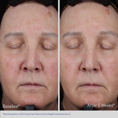 ELASTIderm Lift & Sculpt de Obagi, detalle