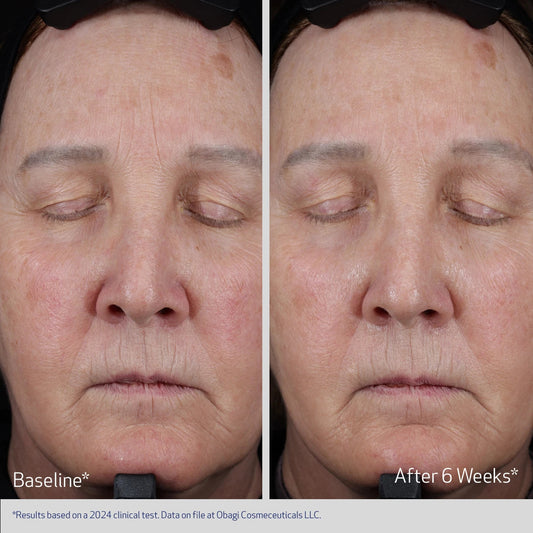 ELASTIderm Lift & Sculpt de Obagi, detalle