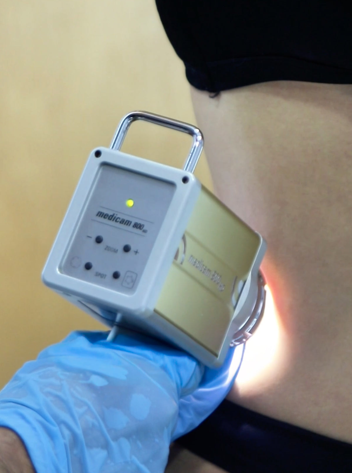 Mapeo corporal digital en Medical Skin Center