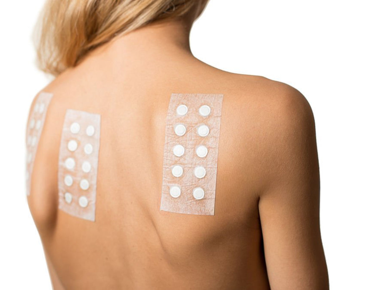 Lectura de reacciones del Patch Test