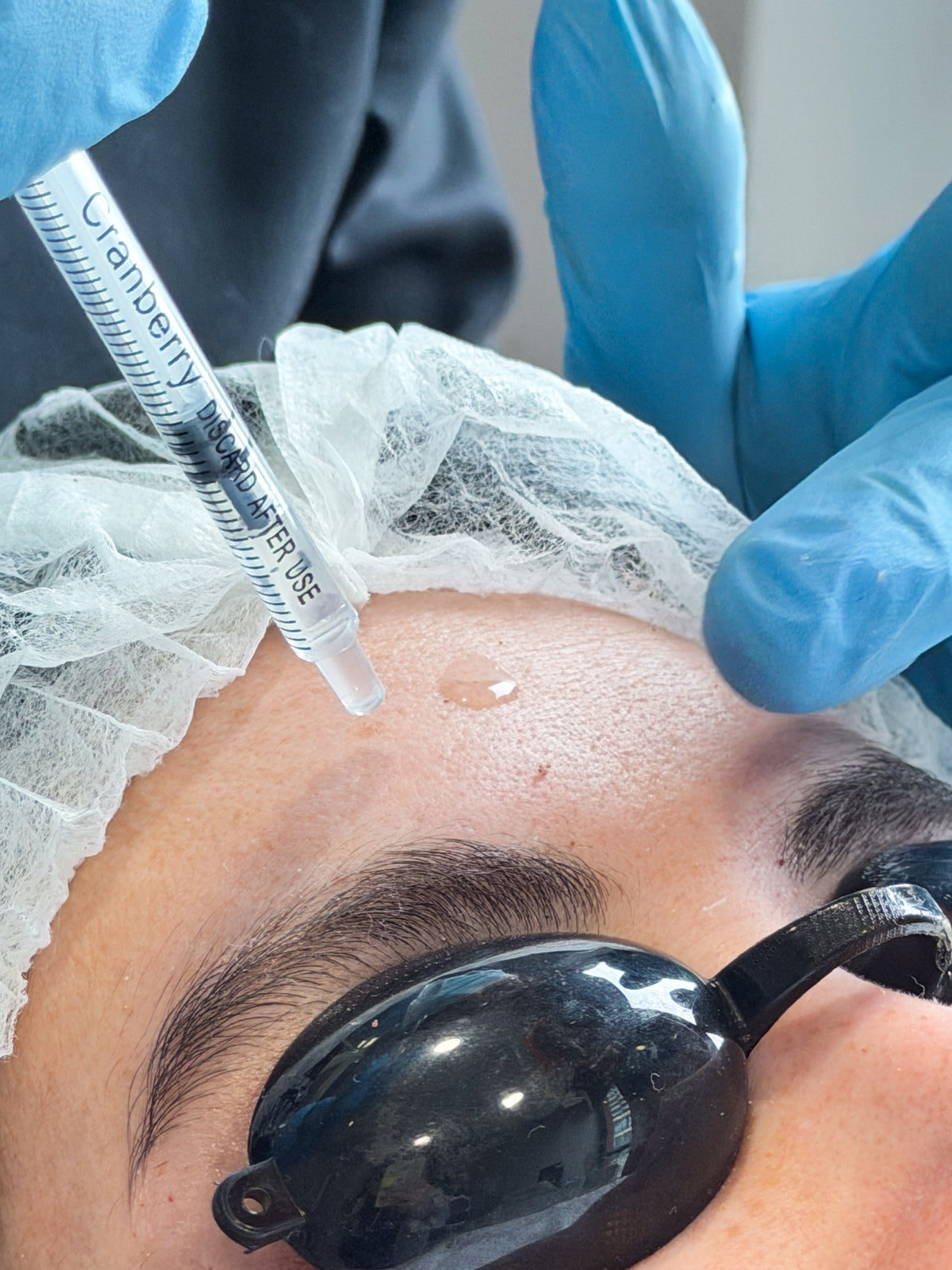 Exosomas y Polinucleótidos en Medical Skin Center