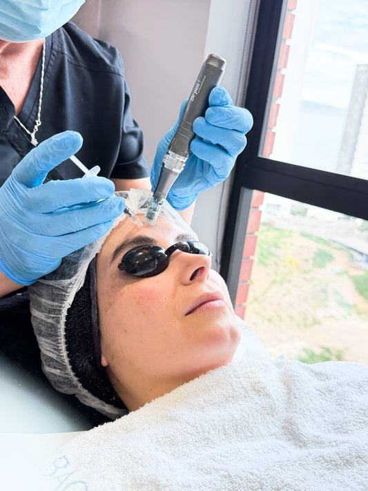 Dermapen con Pink Glow