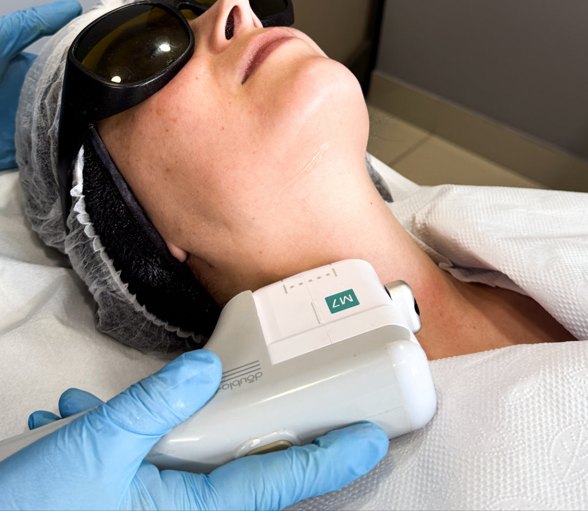 Tratamiento HIFU en Medical Skin Center