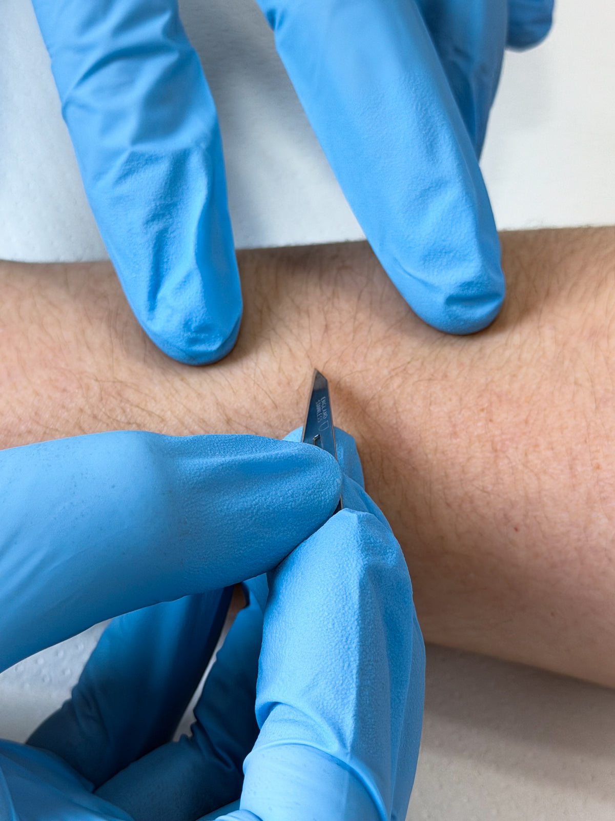 Toma de muestra para Test de Ácaros