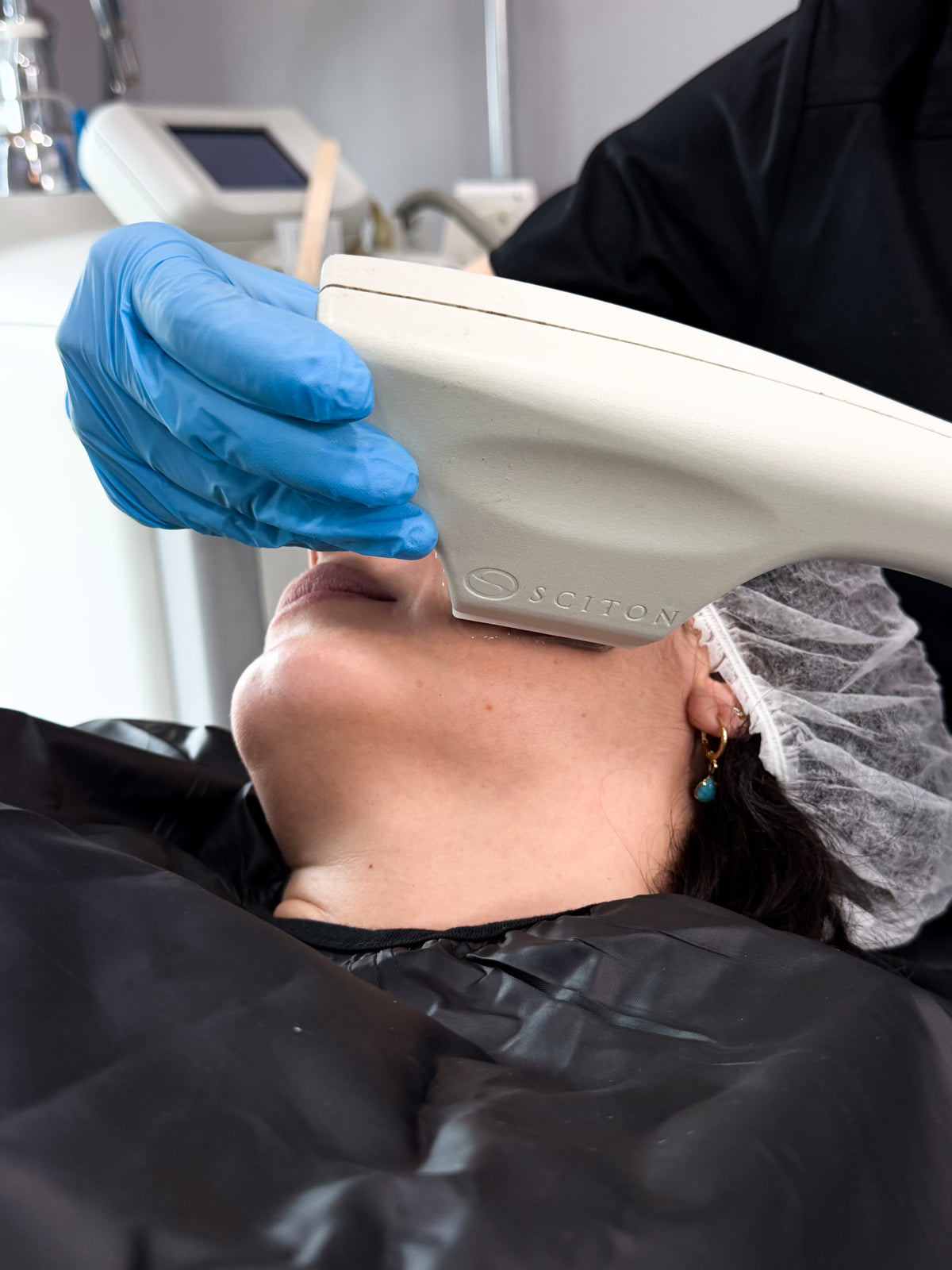 Láser Nd:YAG en Medical Skin Center