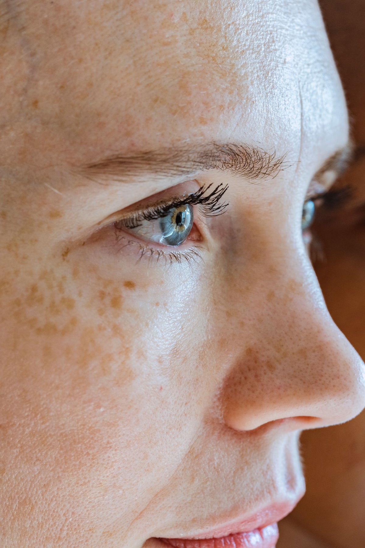 Tratamientos para manchas y melasma
